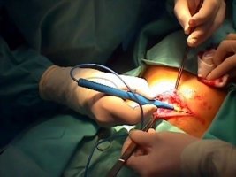 Hospitales privados violentan derecho al parto humanizado